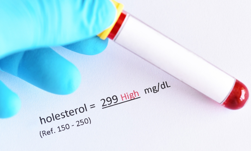 Holesterol je masna supstanca u krvi koja je važna za rad ćelija, ali može biti štetna ako je ima previše