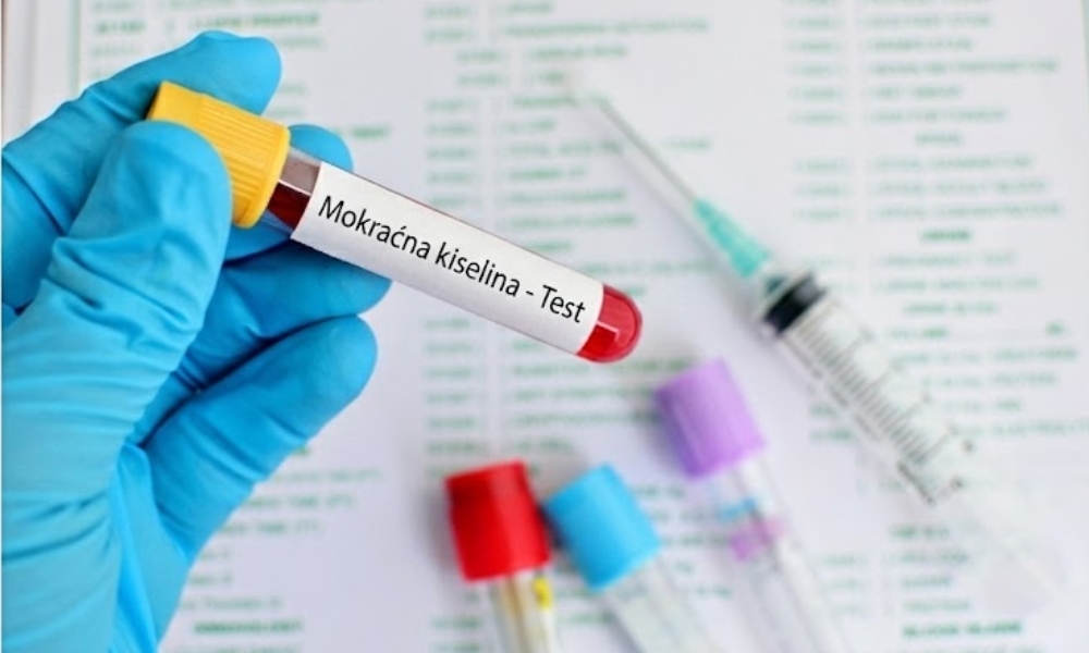 redovna kontrola mokraćne kiseline