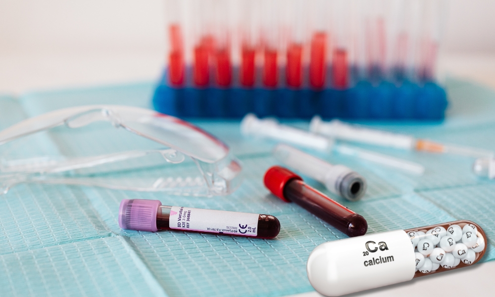 Antagonisti kalcijuma